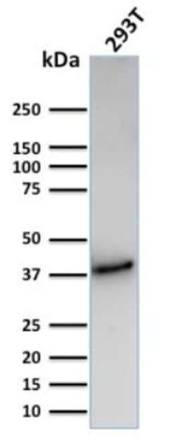 CD74 Antibody (CLIP/3127R) - Azide and BSA Free, Novus Biologicals 100 &mu;g | Buy Online | Novus Biologicals | Fisher Scientific